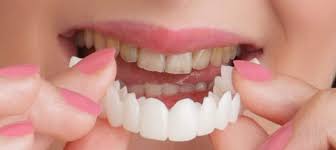 روکش دندان چیست؟