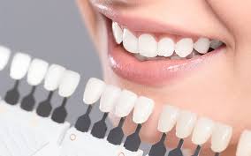 ویژگی های بهترین برند کامپوزیت دندان چیست؟